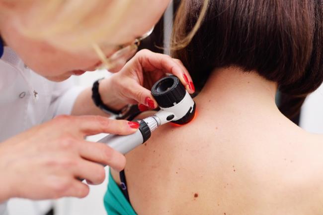 אישה צעירה עוברת בדיקת שומות עקב חשד למלנומה